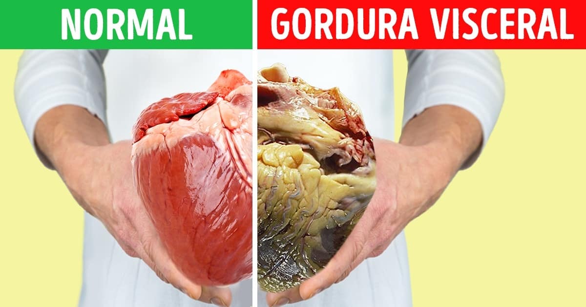 Como se Livrar da Gordura Visceral Como se Livrar da Gordura Visceral